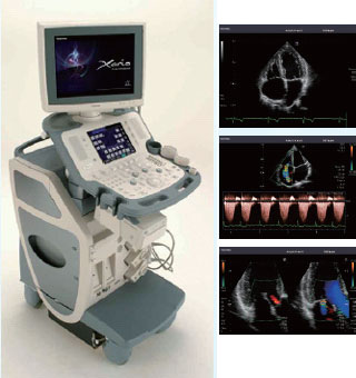 心臓超音波検査の写真